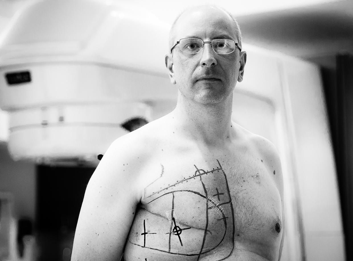 опухоль в районе груди у мужчин фото 87