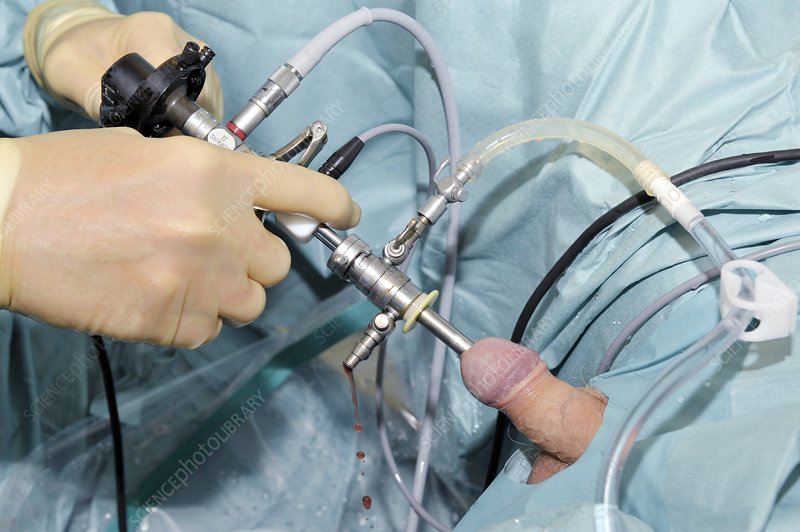 How to insert prostate stimulator