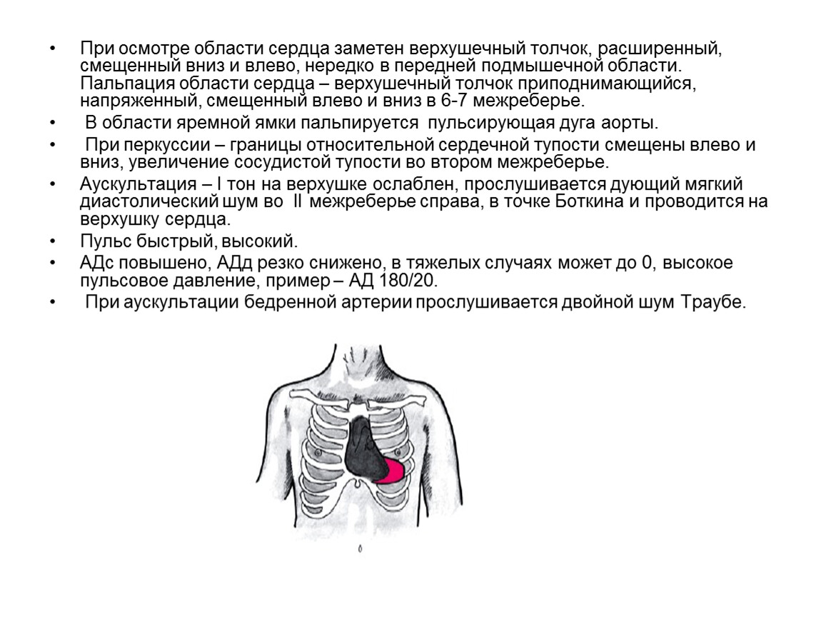 Расширение сердца влево. Пальпация области сердца. Пульсация в области верхушечного толчка. При осмотре сердечной области можно выявить. Верхушечный толчок при осмотре.