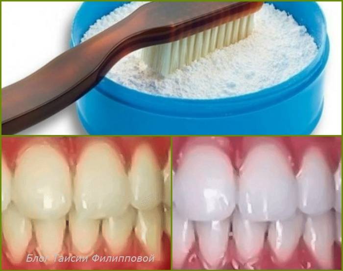 Зуб отбеливание пить. Как отбелить зубы в домашних условиях. Эмаль для отбеливания зубов. Отбеливание зубов в домашних условиях.