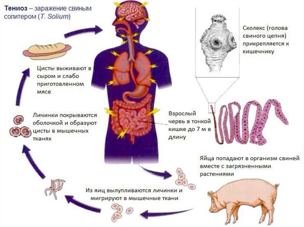Симптомы цепня у человека. Свиной цепень жизненный цикл Taenia solium. Заражение свиным цепнем цикл. Свиной цепень жизненный цикл в организме человека. Цикл свиного солитера.
