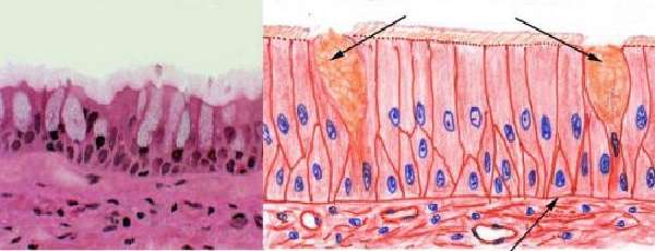 Железистые клетки 