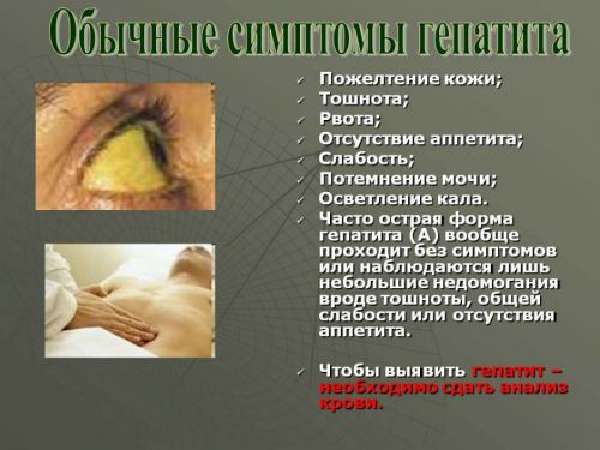 Симптомы гепатита
