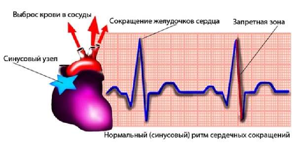 Расшифровка кардиограммы