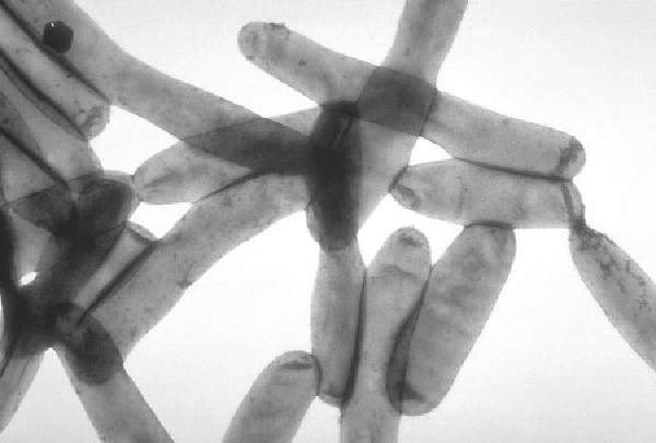 Legionella pneumophila - возбудитель атопической пневмонии