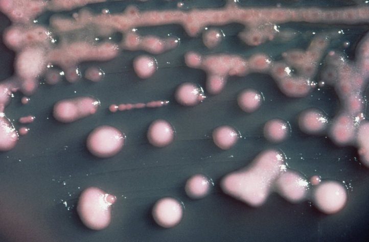 бактерия клебсиелла пневмония