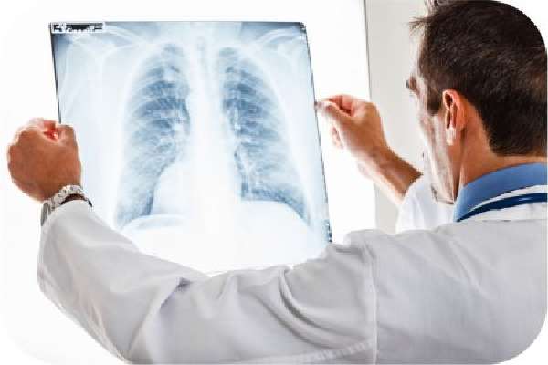 lung_xray