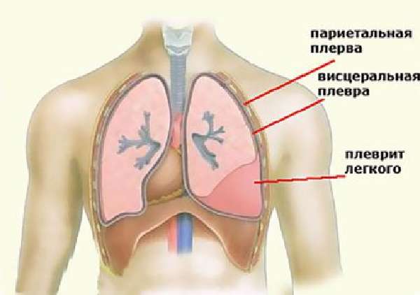 Крепитация в лёгких