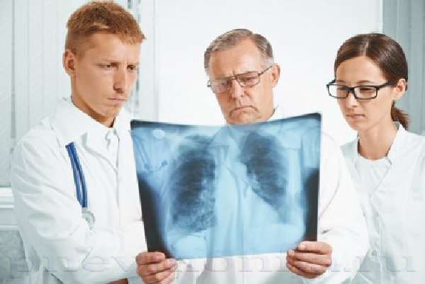 тотальная пневмония на рентгеновском снимке