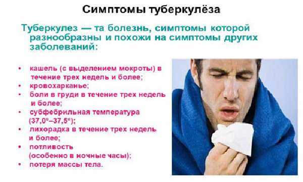 Симптомы туберкулеза