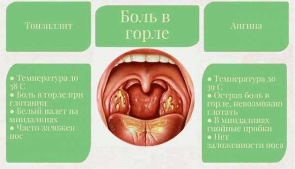 Инфекционные причины боли в горле