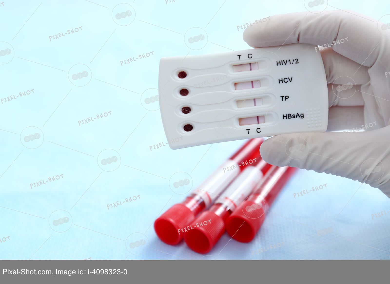 Экспресс тест на ВИЧ гепатит в и с