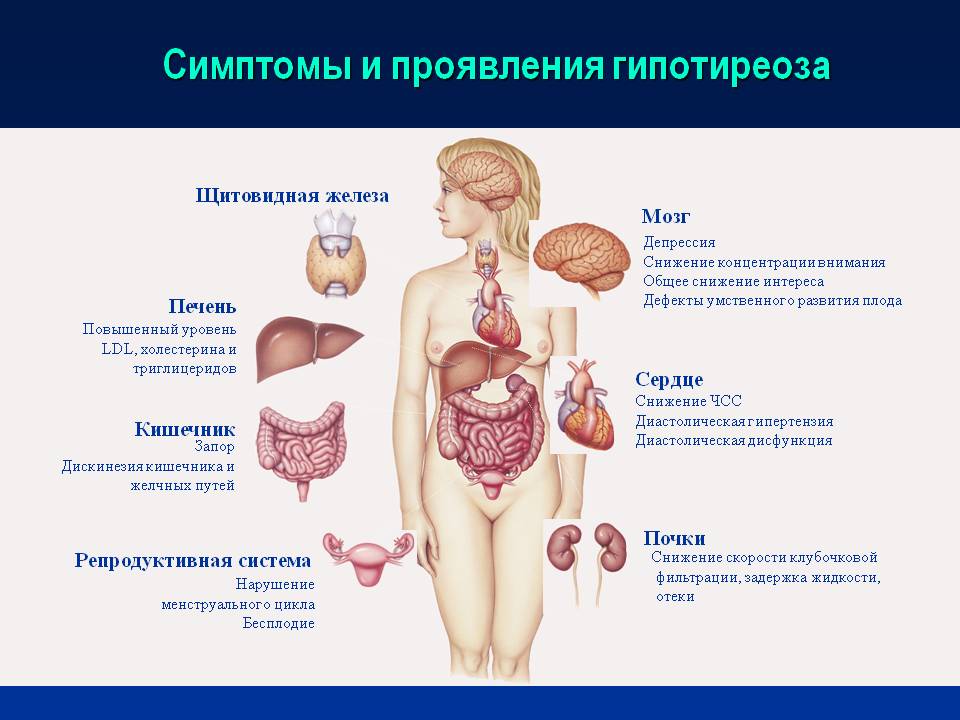 Щитовидная железа форум больных. Гипотиреоз органы мишени. Симптомы сниженной функции щитовидной железы у женщин. Снижение функции щитовидной железы симптомы у женщин. Гипотиреоз недостаток гормонов симптомы.