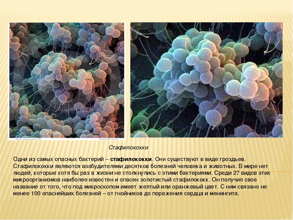 Staphylococcus aureus 3. Стафилококк 3.3. Вредные бактерии для человека. Вредные микроорганизмы для человека. Бактерии в организме человека названия.