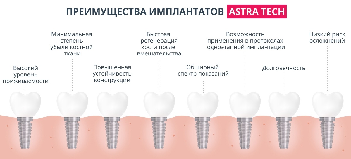 Зубы импланты поэтапно. Имплант Astra Tech 2023. Импланты коронка Штрауман. Схема установки импланта. Зубные импланты схема установки.