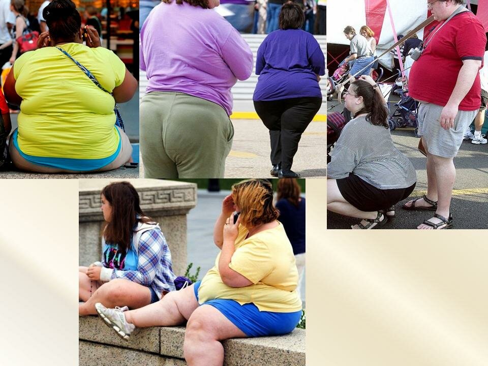 Страдающие лишним весом. Ожирение. Ожирение у девушек.