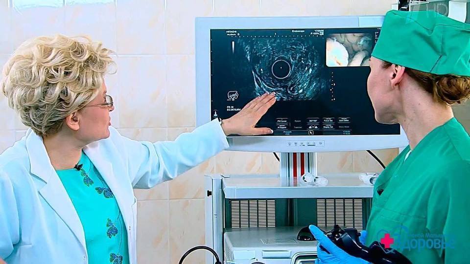 Колоноскопия: полная информация о процедуре. зачем назначается, как к ней подготовиться, а также проведение и расшифровка результатов колоноскопии