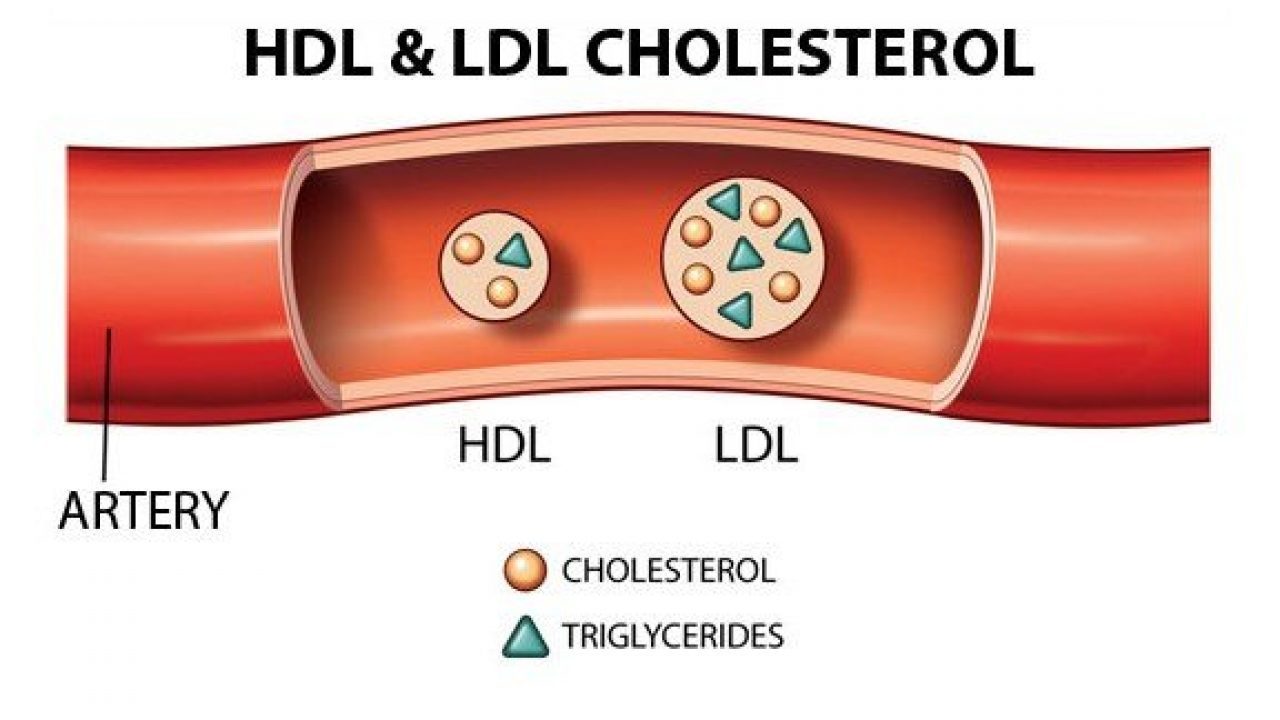 Что значит плохой холестерин