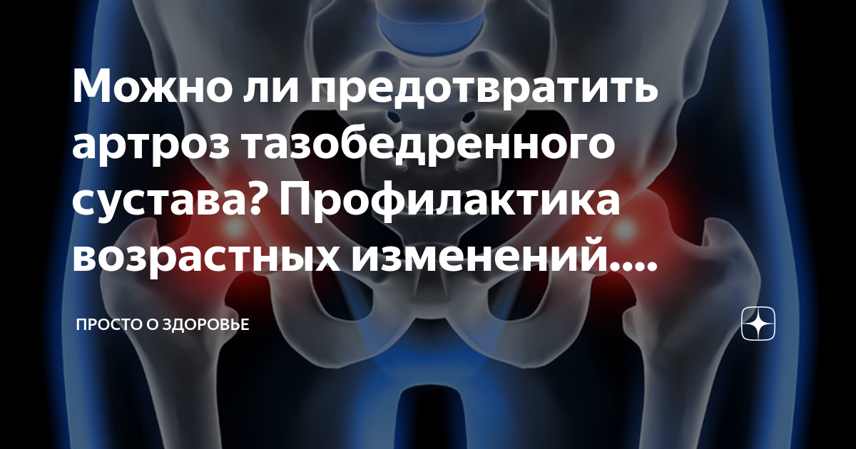 Признаки заболевания тазобедренных. Спондилоартроз тазобедренного сустава. Профилактика болезней тазобедренных суставов. Фукс артроз тазобедренного. Симптомы заболевания суставов таза у женщин.