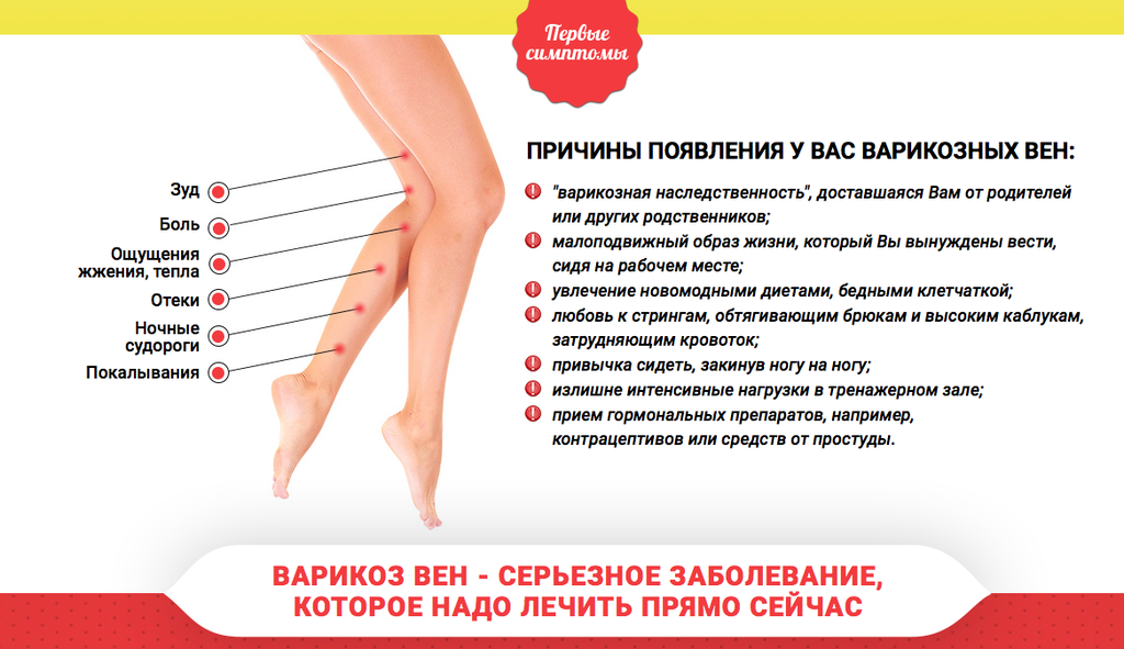 Отёки ног. причины, симптомы и лечение отека ног!