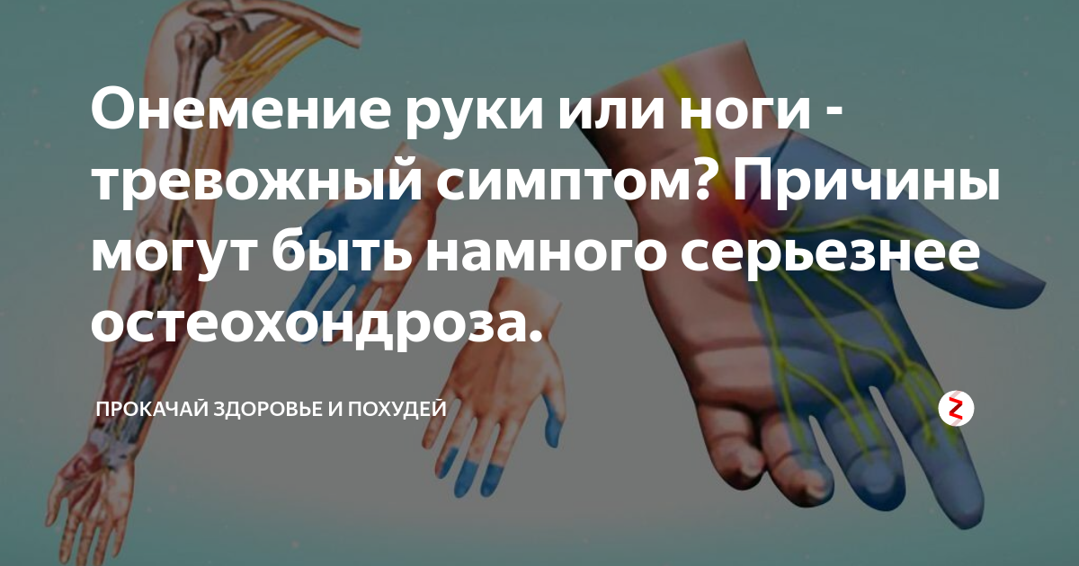 Немеет тело. Онемение рук. Остеохондроз немеют руки. Онемение пальцев парестезии.