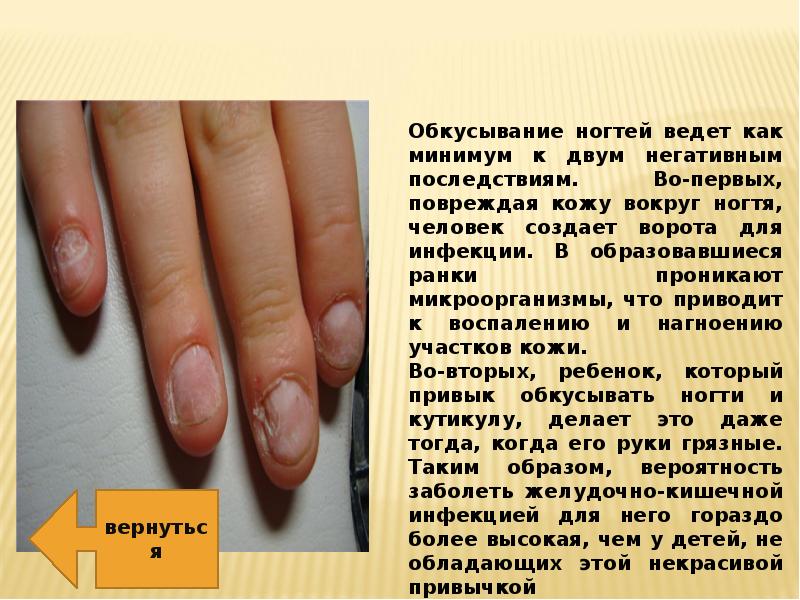 Диагностика здоровья по ногтям рук. как определить болезни по ногтям? форма ногтей и здоровье