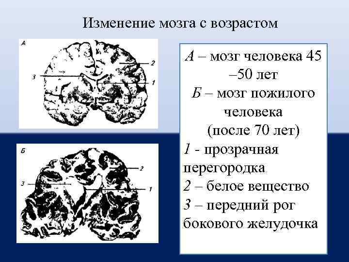Возраст мозга 1