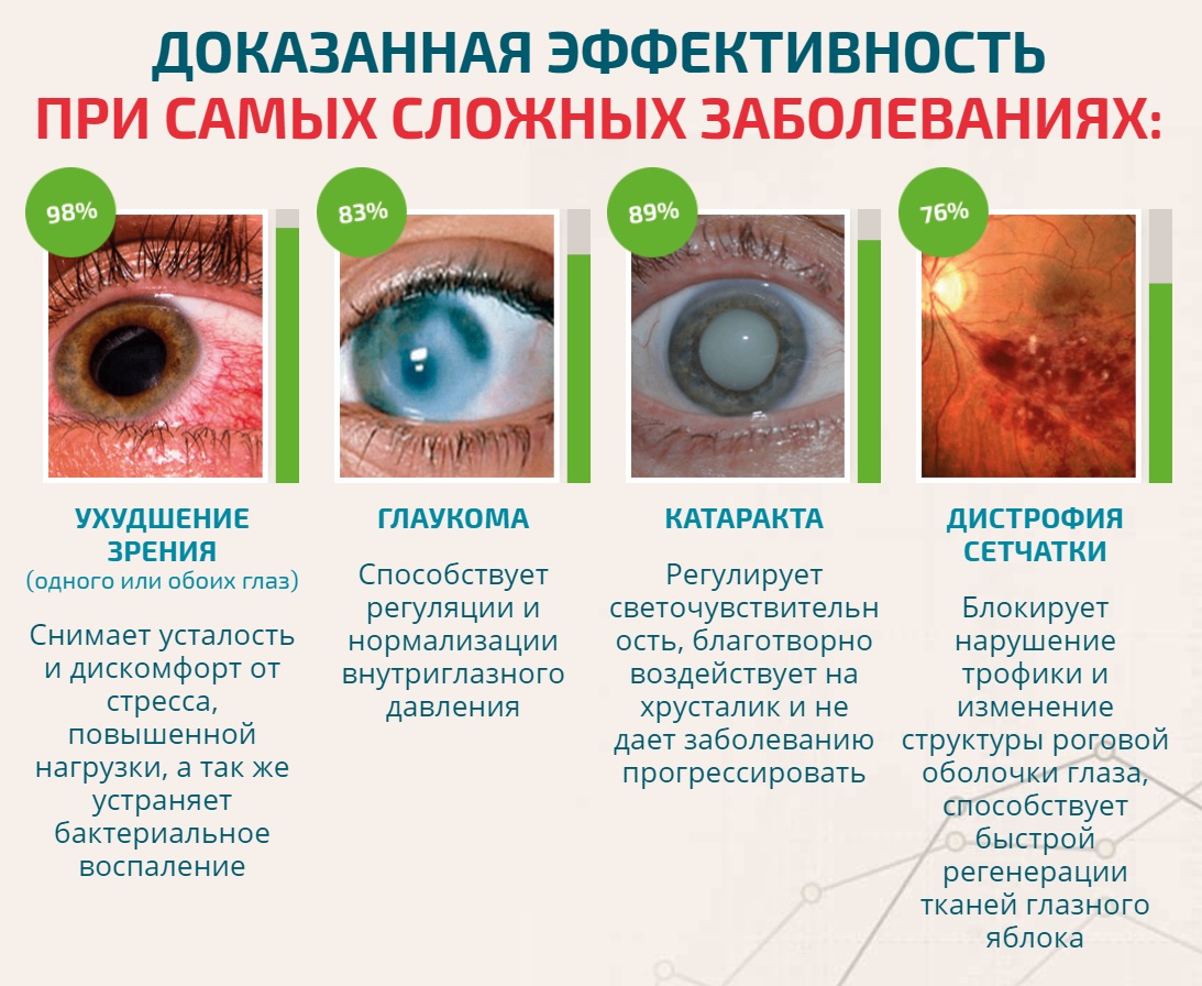 Возрастная катаракта - стадии и виды сенильной катаракты глаза