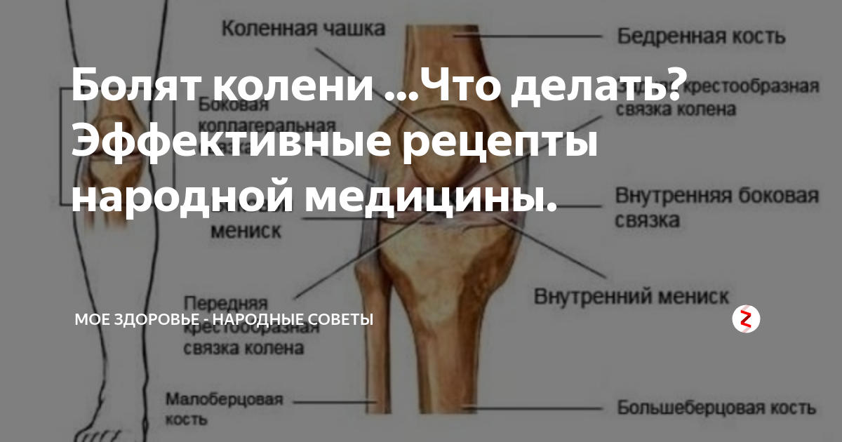 Больно разгибать. Сильнейшие боли в коленном суставе. Локализация боли в колене.