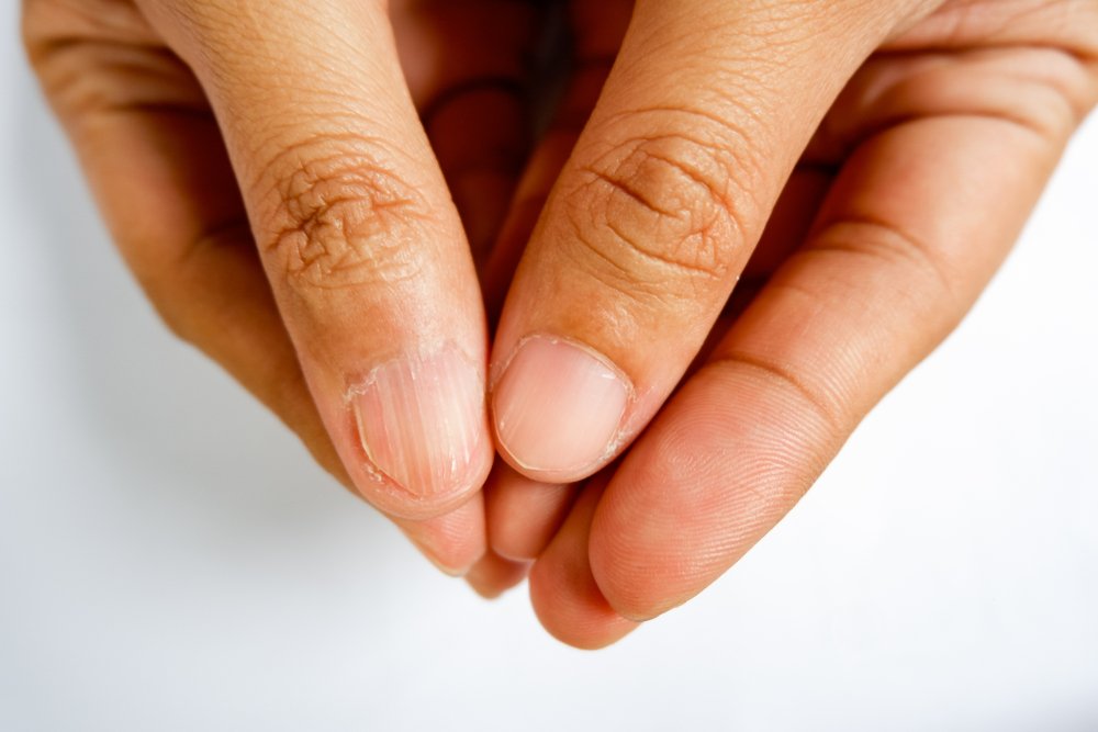 Ногти: основные заболевания * клиника диана в санкт-петербурге