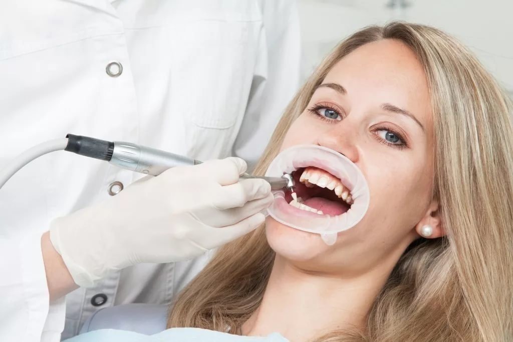 Чистка зубов у стоматолога фото