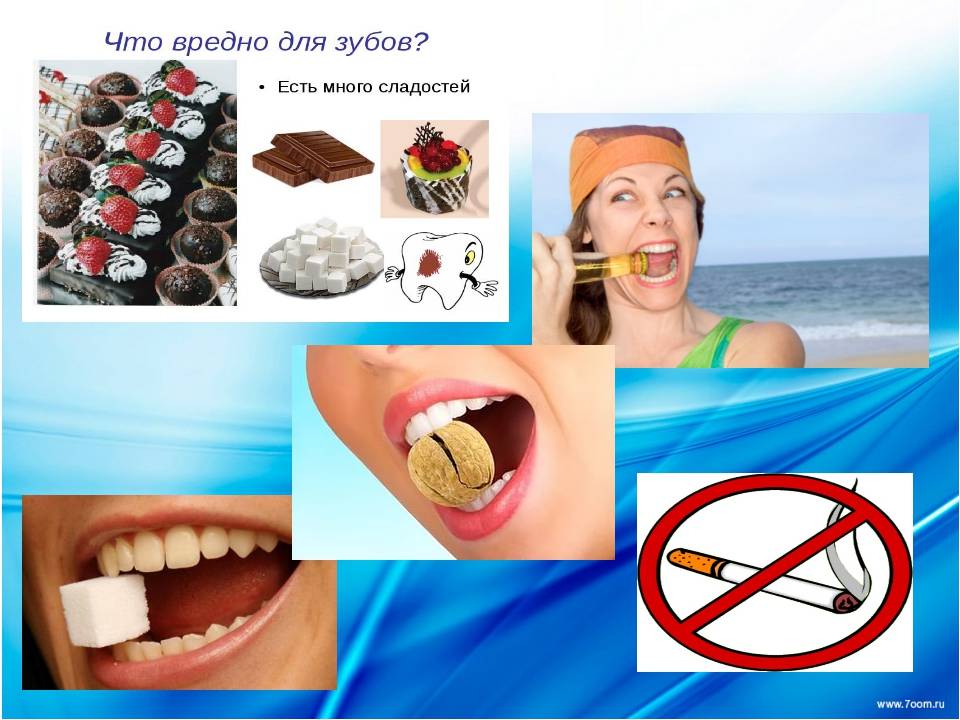 Сладости в умеренном количестве не вредят здоровью. Вредные привычки для зубов. Вредные продукты для зубов. Полезные продукты для зубов. Полезные и вредные продукты для зубов.