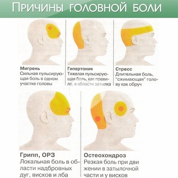 Временами болит затылок. Схема локализации головной боли. Причины головной боли.