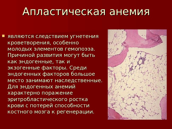 Анемия следствия. Апластическая анемия красный костный мозг. Апластическая хлоронемия. Метаплас тическая анемия. Асблрсиическая анемия.