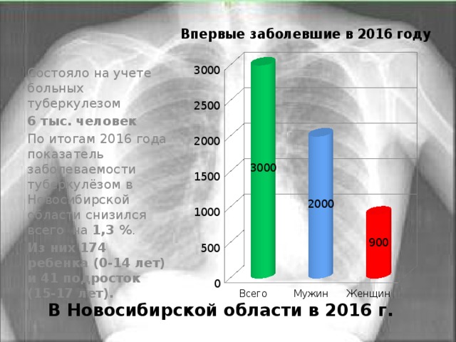 Сколько туберкулеза в россии. Заболеваемость туберкулезом. Статистика больных туберкулезом. Показатели туберкулеза. Туберкулезом чаще болеют.