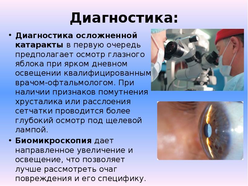 Все о катаракте глаза: симптомы, диагностика и лечение заболевания (медикаментозное и хирургическое) - moscoweyes.ru - сайт офтальмологического центра "мгк-диагностик"