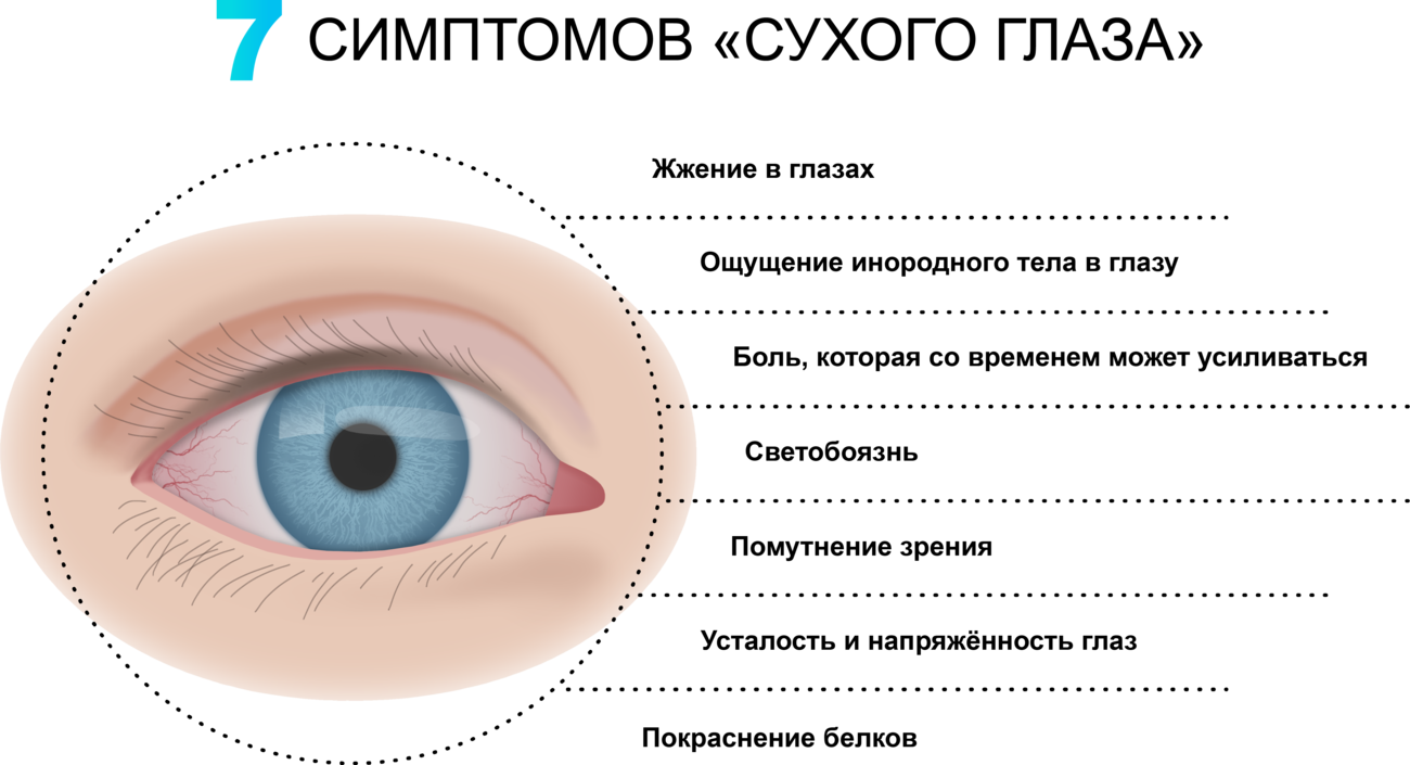 Веках почему е. Причины развития синдрома сухого глаза. ССГ (синдром сухого глаза. Синдром сухого глаза профилактика. Причины возникновения синдрома сухого глаза.