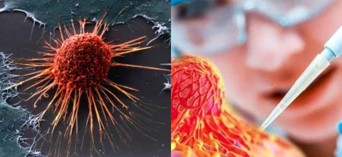Диета против рака: какие продукты полезны для профилактики онкологических заболеваний