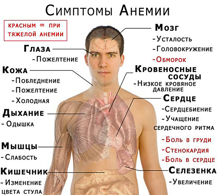 Анемия: к какому врачу обратиться. симптомы и лечение анемии