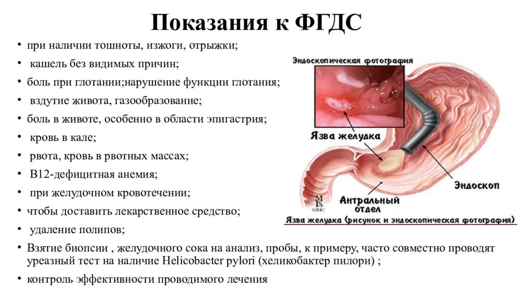 Излечим ли рак? прогноз выживаемости на разных стадиях выявления