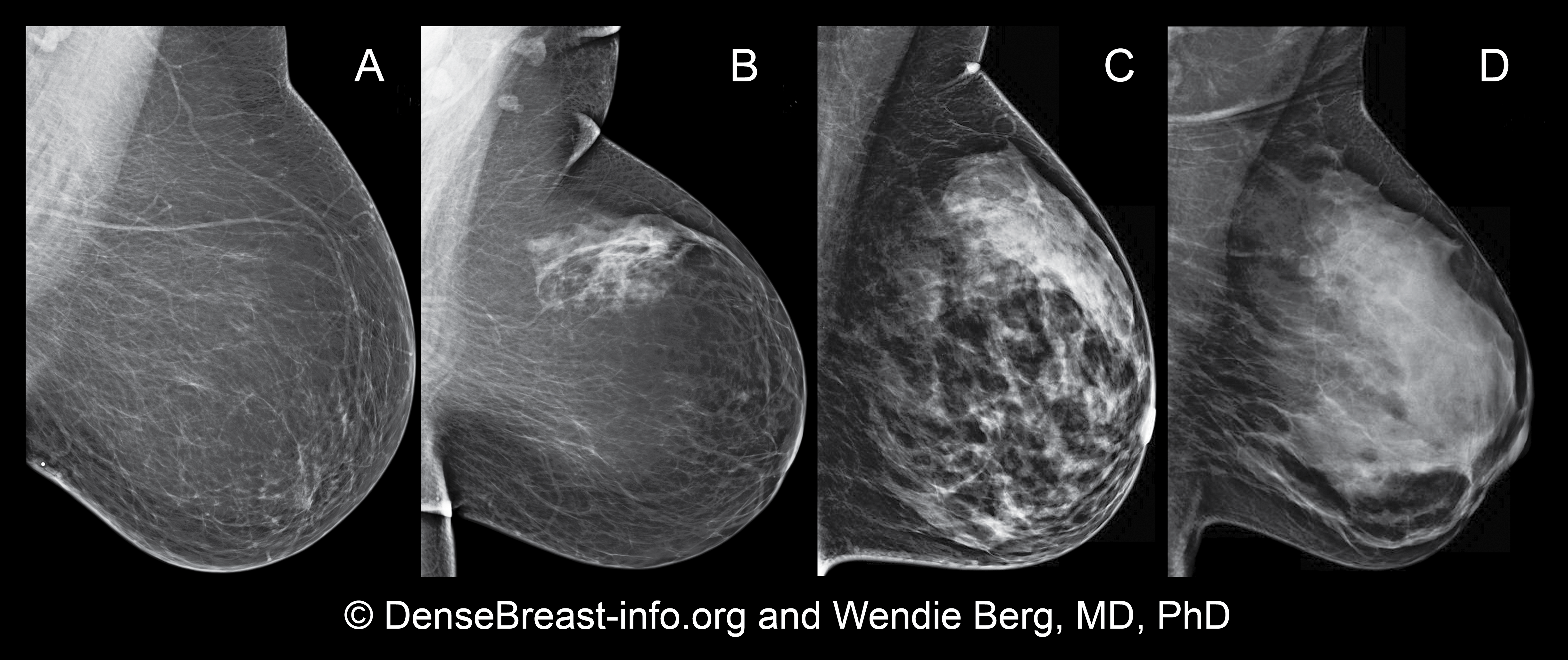 первые признаки рака груди у женщин симптомы фото 68