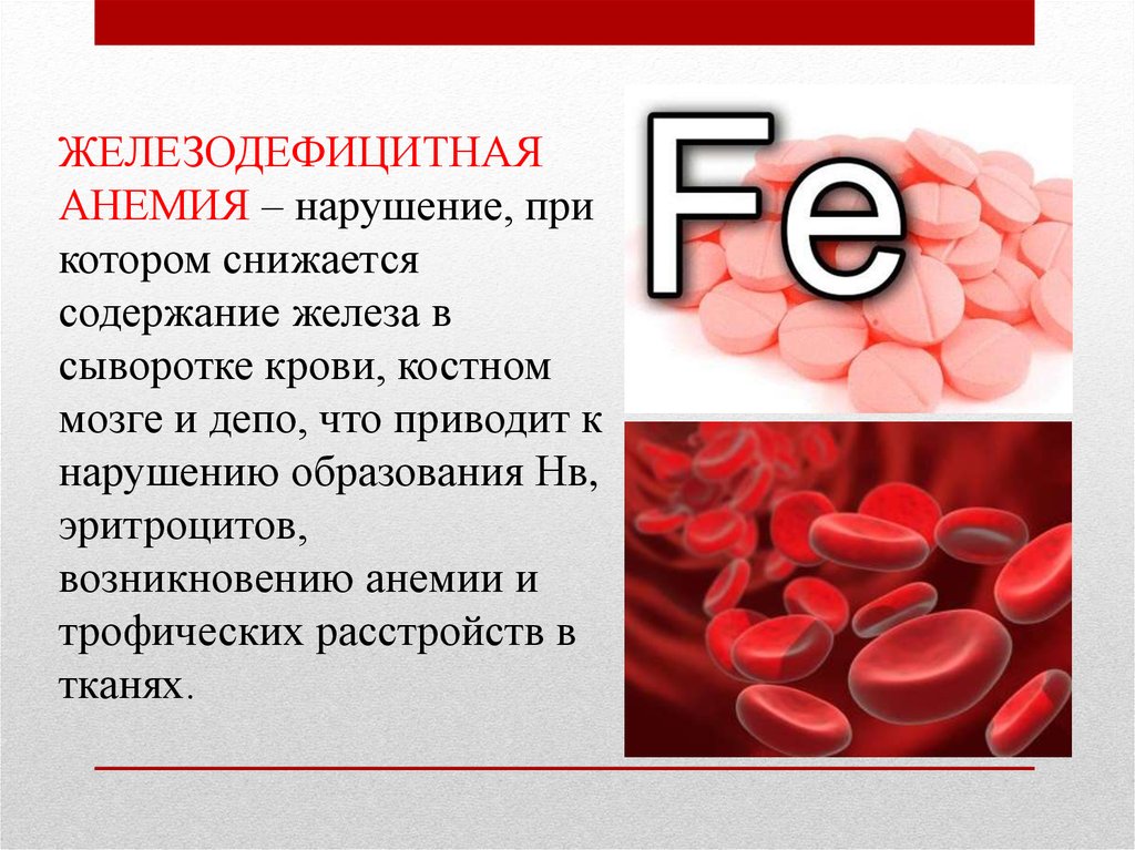 Анемия сопровождается. Железнодефецитная Анимия. Железодефицитная анемия проявления. Железодефицитная анемия (жда). Железо крови при железодефицитной анемии.