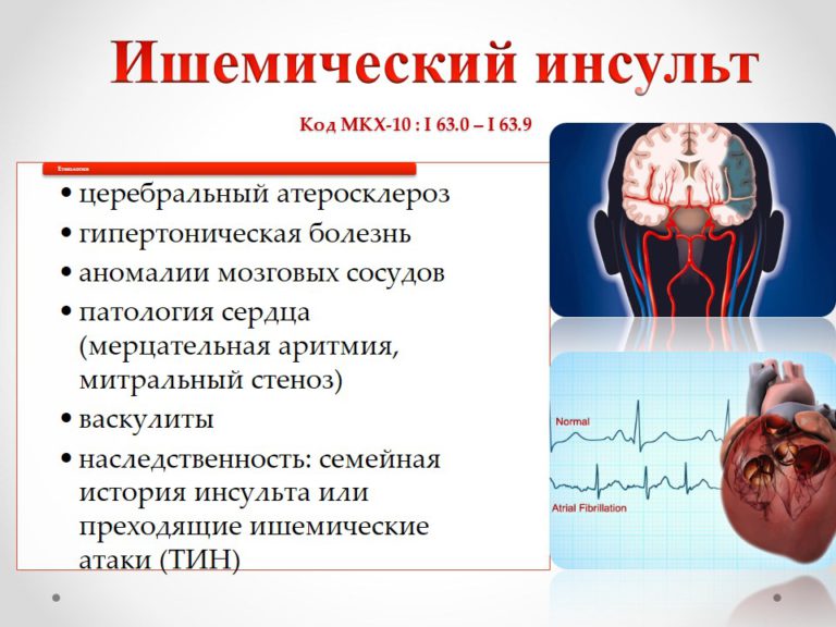 Стадии ишемии головного. Причины ишемического инсульта. Ишемический инсульт симптомы. Последствия ишемического инсульта головного. Ишемический сердечный инсульт.