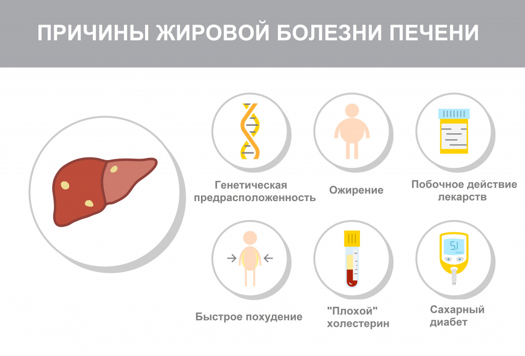 Фосфоглив при жировом гепатозе: лечение гепатоза лекарственным препаратом