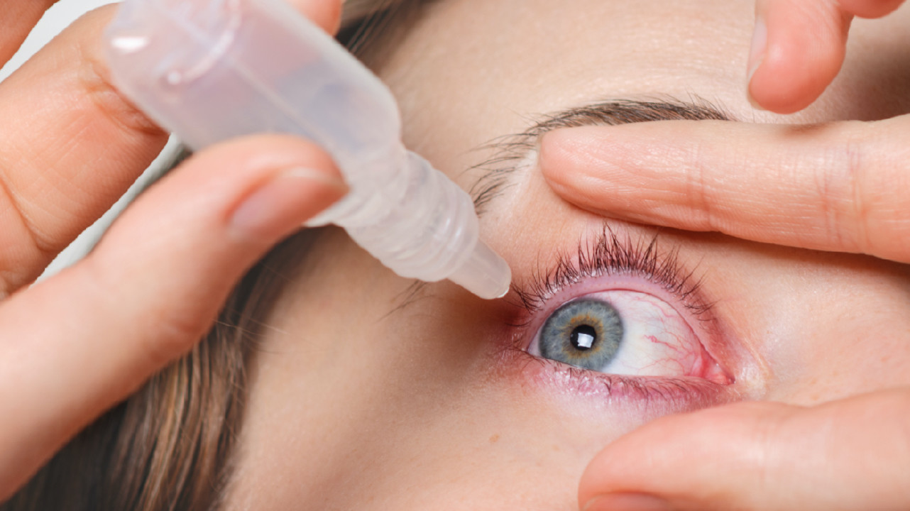 Сухой глаз симптомы капли. Офтальмогерпес кератит. Роговично-конъюнктивальный ксероз. Мейбомиевый кератоконъюнктивит. Сухость глаза (ксерофтальмия).