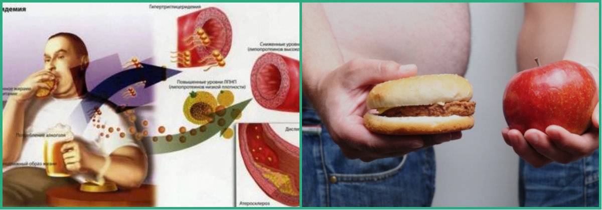 Коварная стройность и безопасная полнота: метаболический синдром и сахарный диабет вне обычных границ индекса массы тела
