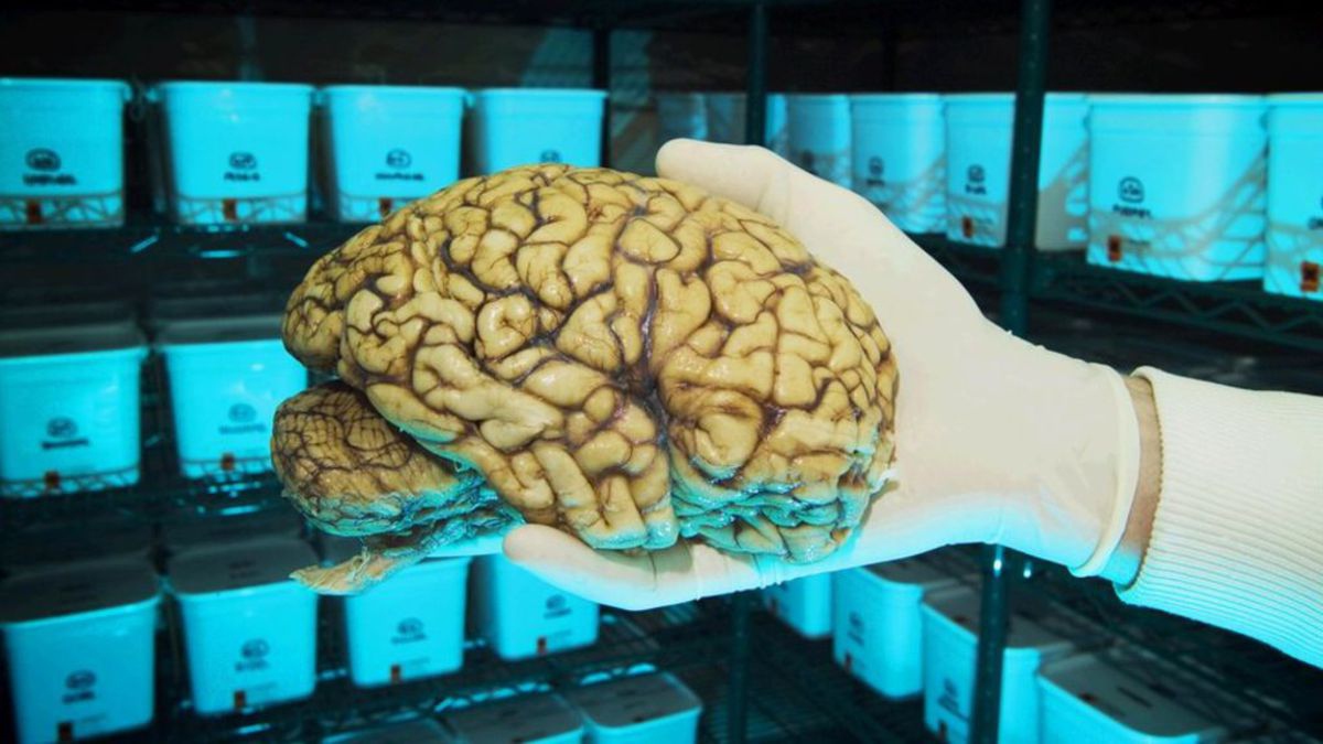 Самый быстрый мозг. Человеческий мозг живой. Настоящий человеческий мозг.